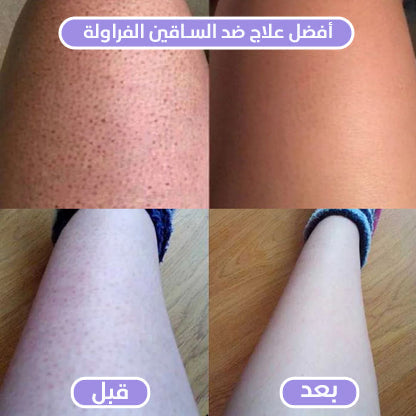 2-in-1 Women's Body Shaver ماكينة حلاقة نسائية 2 في 1 للجسم